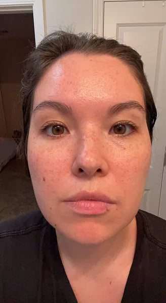 Zoe after 1 week using Wild Ice