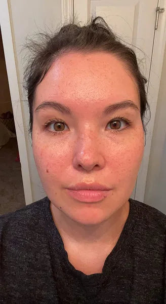 Zoe after 3 weeks using Wild Ice