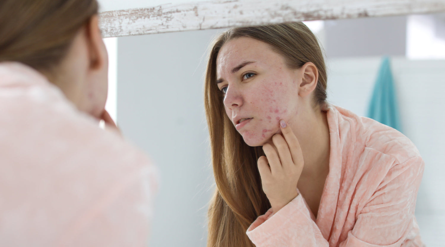 Is Your Skin Getting Worse Before It Gets Better? The Truth About Purging vs. Breaking Out