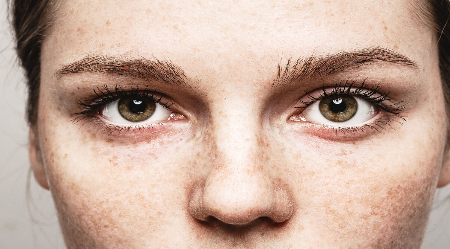 The Ultimate Guide to Tightening Skin Around the Eyes: Beyond Creams and Concealers
