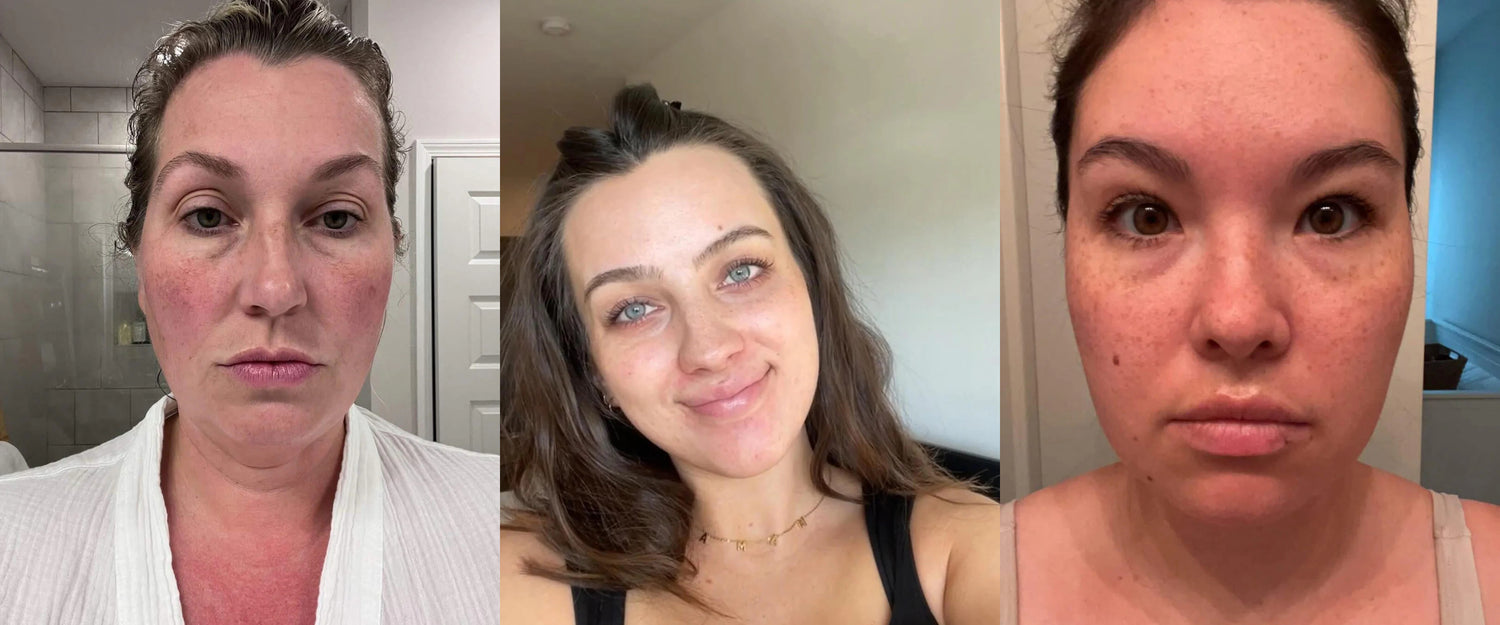 Before Wild Ice skincare