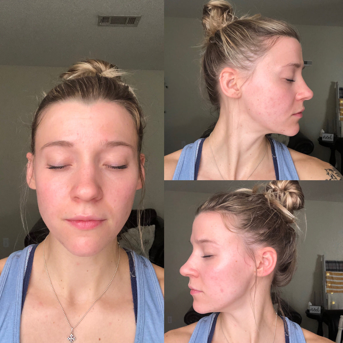 Same customer at week 6, three angles