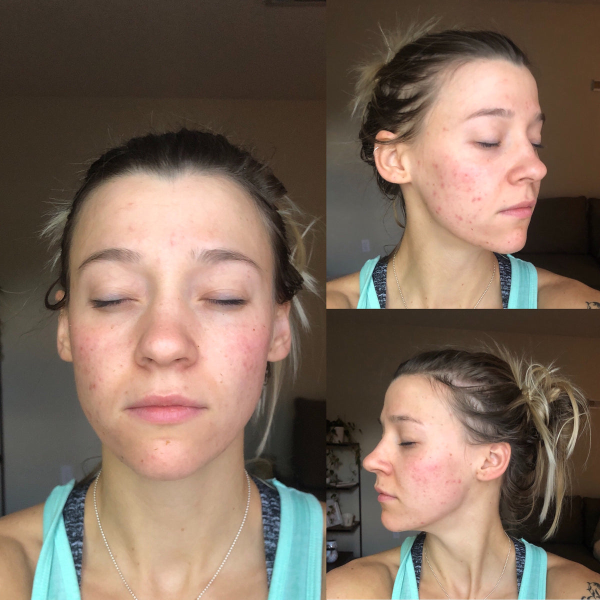 Customer at week 1, three angles
