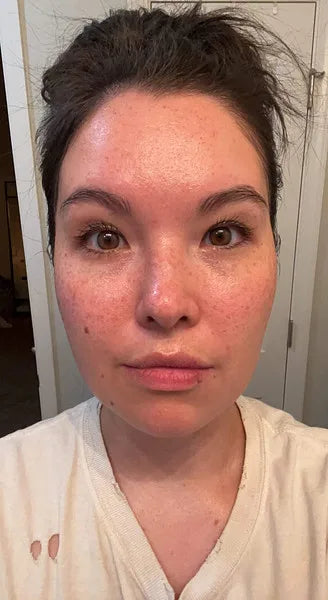 Zoe after 2 weeks using Wild Ice